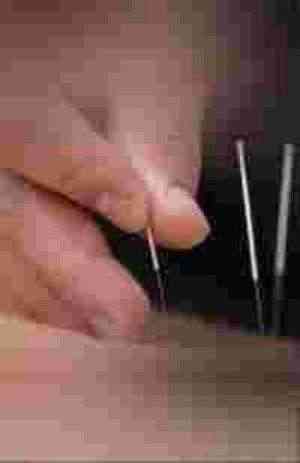 特别报道 中国最具影响力医学大师——齐生亮