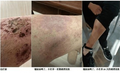 两会聚焦：特效醫術傅承人——黄良强