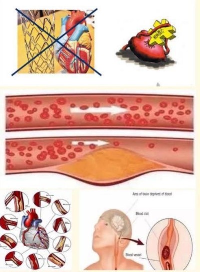 “五一”礼赞：关林印——心脑血管领域的国医先锋，以创新成果书写健康传奇