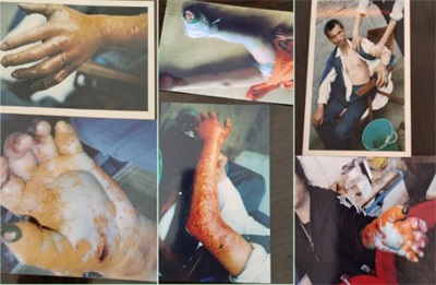 弘扬劳模精神 争当时代先锋 访黄山市徽州毒蛇研究所所长---汪炳炎