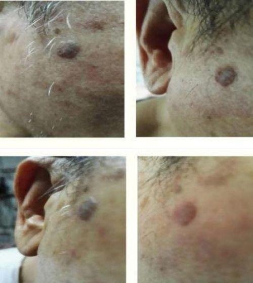 2026元旦特别报道量子氢氧健康第一人长寿哥(廖永贵)