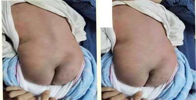 聚焦全国两会・非遗瑶医护民生 — 自治区级非遗传承人周继辉的守正与践行