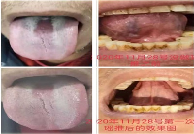 聚焦全国两会・非遗瑶医护民生 — 自治区级非遗传承人周继辉的守正与践行