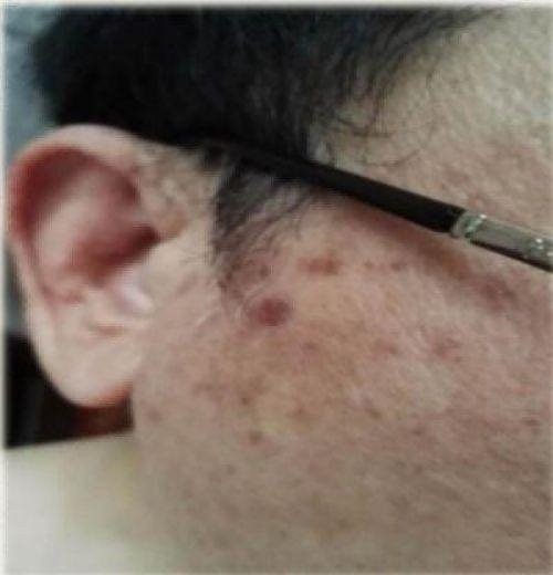 践行“十五五”健康中国战略： 量子氢氧健康第一人廖永贵——用科技点亮生命健康之光