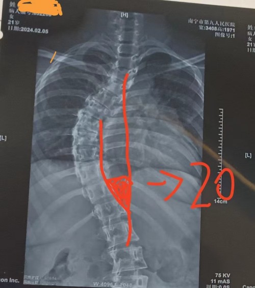 宫廷整脊正骨：王洪喜与通脉整骨堂的百年非遗传承之路