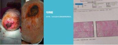 访新时代大健康科研人才 兰溪永球医院院长---宁永球