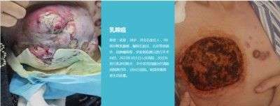 访新时代大健康科研人才 兰溪永球医院院长---宁永球