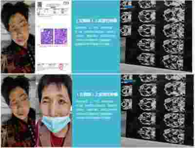 访新时代大健康科研人才 兰溪永球医院院长---宁永球