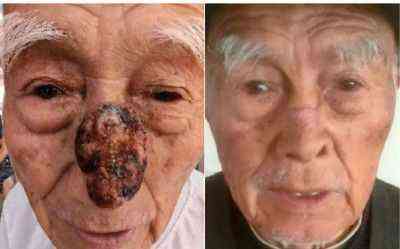 访新时代大健康科研人才 兰溪永球医院院长---宁永球