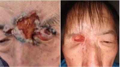 访新时代大健康科研人才 兰溪永球医院院长---宁永球