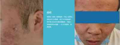 大国医者 国医名师——宁永球