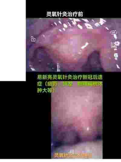 灵氧细胞百病断根疗法让三高断药风湿断根肿瘤不要化放疗的奥秘