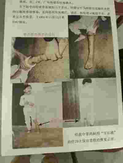 【全国知名中医专家报道】 新时代国医名师—谢宝石